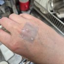 이노유지 | 이노테이프 의료용실리콘테이프 직접 써본 솔직 후기