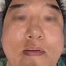 동탄 경락 피부관리 윤곽 스트레칭 에스테티아동탄점 후기