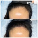 프로스칼프부산 이미지