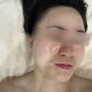 경산 중산동 물오른 피부 맞춤 피부 수분 관리 후기