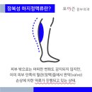 종아리핏줄 그냥 넘기지 마세요!! 이미지