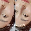 포가_D