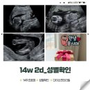 서울유산부인과의원 | [14w2d] 14주 성별확인 평택서브산부인과 서울유산부인과 다이소 젠더리빌diy
