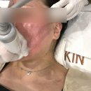 오피메디 | 수완지구피부관리 ㅣ365메디스킨에서 받은 광주플라즈마 원탑..