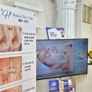 에이치필 이미지