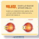 천안삼성안과의원 이미지