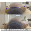 밸런스힐체형교정센터