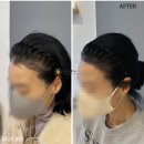 진헤어라인 이미지