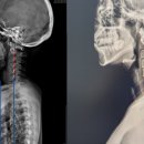 물리치료사의 바디포스쳐 PT 이미지