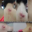 SNPE 바른자세 척추운동 이미지