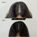 명도헤어라인 네이버블로그