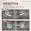 바를정치과의원 네이버블로그