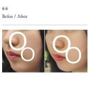 탑뷰티클래스 | 인하대역 피부관리 탑뷰티클래스에서 sono 물방울 리프팅/하이푸 관리 재방문 후기