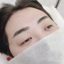 앙비떼
