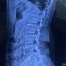 대구자생한방병원 | 자생한방병원대구점 방문후기_허리통증 받고 온 경험