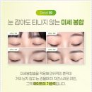 자연 | 자연유착 쌍꺼풀 후기, 쌍꺼풀 수술 가격 참고해봐요