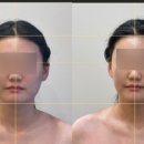 라즈뮤에스테틱