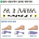공주 베네슈 신관점 기능성 건강신발 착용 후기