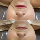 야당피부관리 서연뷰티에서 피부고민 해결
