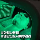 아리나 | 검단신도시 피부관리 아리나뷰티 프락셔널 레이저 관리 후기