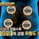 젊은 층 대장암 증가 원인 이미지
