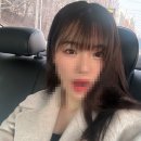 슈가성형외과의원 | 07. 내돈내산 자연유착 뒷밑트임 눈매교정 후기