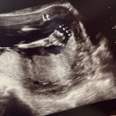 7. 틈틈이 행복도 해야해, 포항 서울에서.