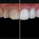 티유치과기공소 이미지