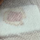 고윤희산부인과외과의원 | [칠곡 외과 추천]겨드랑이 멍울 통증 원인과 시술비용 후기