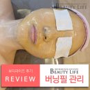 버닝헤드 | 안산고잔동피부관리실 추천 뷰티라이프 버닝필 후기
