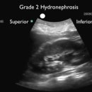 06 Kidney-Urinary bladder 이미지