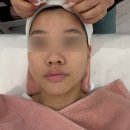 4153 | 원흥역피부관리 4W에스테틱 | 건조하고 예민한 피부 LDM 관리 솔직 후기