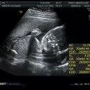 11260-1-21-18 | 임신 18~21주차! 임신 황금기임을 입증하는 임신 중기 여행 및 일상기록!