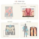 갱신형 특정눈염증진단비(연간1회한)보장 특별약관 이미지
