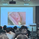 순천열린치과 네이버블로그