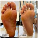 겸스네일