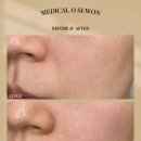 세마메디칼 이미지