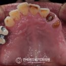 연세원드림치과의원 네이버블로그