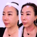 제이메디칼 | [내돈내산] 대구 대명동 뷰티제이 메디 스킨랩 방문 후기