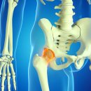 수원고려본정형외과의원 이미지