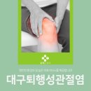대구퇴행성관절염 원인알고 치료해야