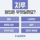 치루개 이미지