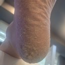케어샵 네이버블로그