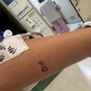 개화약국 | 30대 여성의 관내유두종, 개화성 유관증식증 후기 3탄 | 수술 후기 그리고 그 후