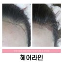 캣츠라인