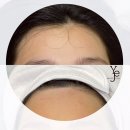 아씨헤어라인 이미지