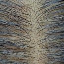 경주굿모닝병원 | 내돈내산 경주두피문신 완전 잘하는 곳 추천 "헤드라인유"