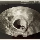 박동 | [임신로그] 7주차 초음파 후기 | 심장박동 확인, 입덧의 시작