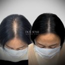 강동-천호-4699 | 압구정 청담 두피문신 차별화된 자연스러움의 비밀