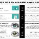 고안경 네이버블로그